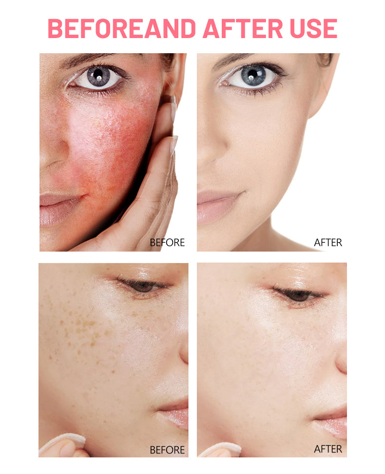 Kit Facial 5 Piezas